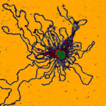 Adenovirus.JPG
