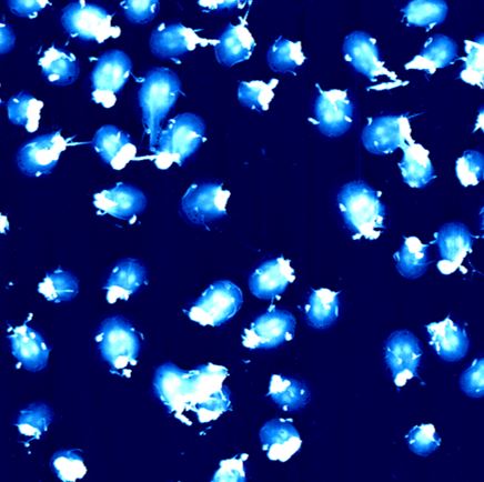 Giardia_liquid.JPG